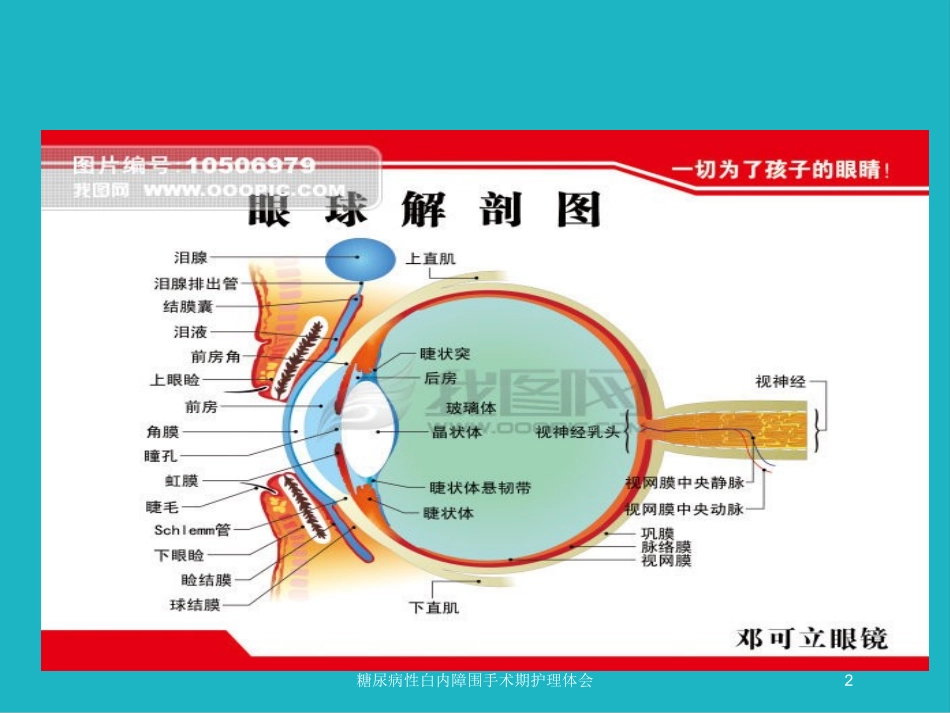 糖尿病性白内障围手术期护理体会培训课件.pptx_第2页