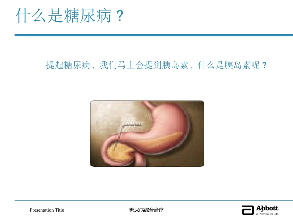 糖尿病综合治疗培训课件.pptx_第3页