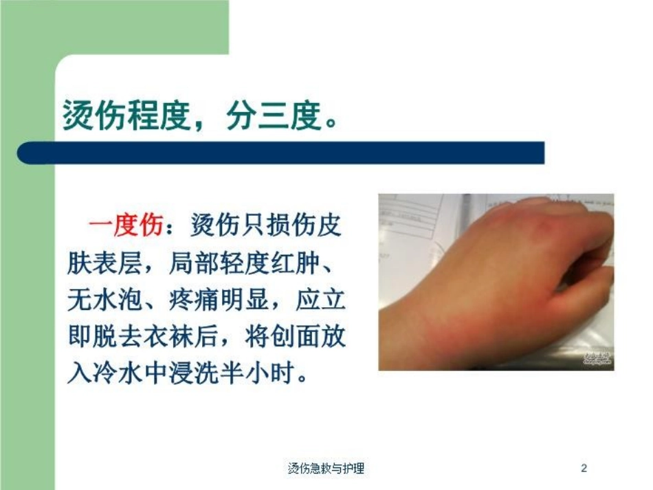烫伤急救与护理培训课件.pptx_第2页