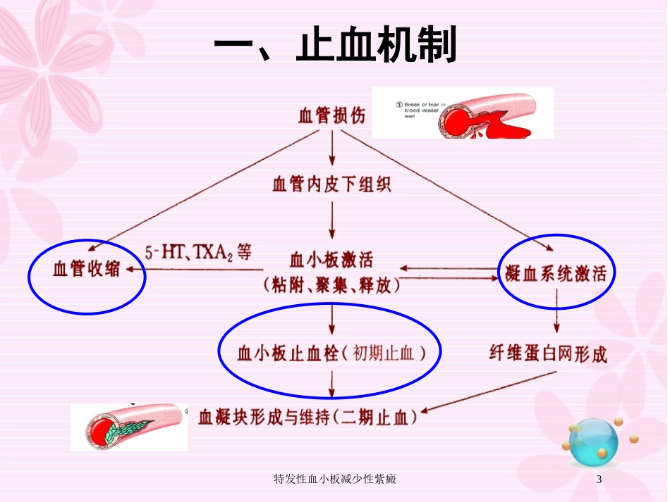 特发性血小板减少性紫癜培训课件.pptx_第3页