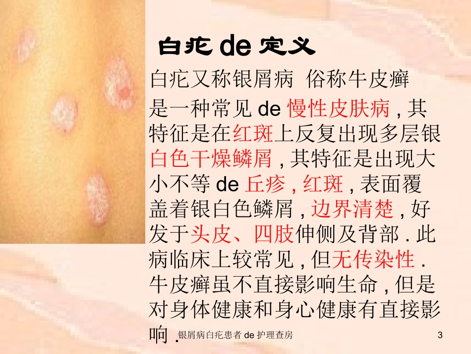 银屑病白疕患者的护理查房培训课件.pptx_第3页