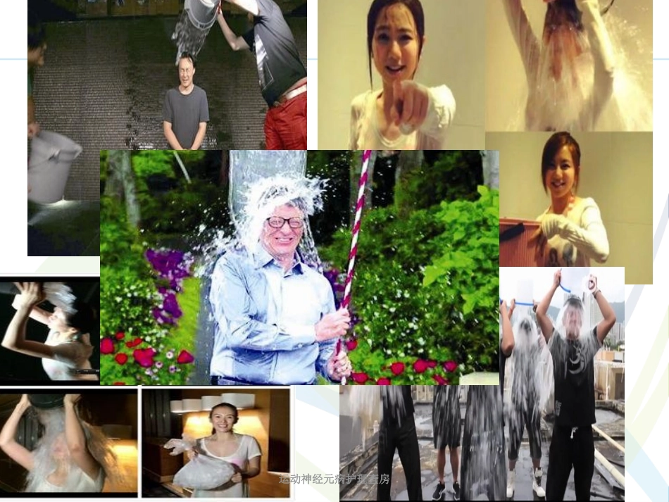 运动神经元病护理查房培训课件.pptx_第2页