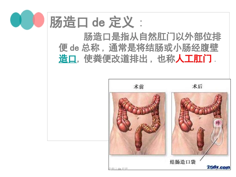 造瘘口的护理培训课件.pptx_第2页