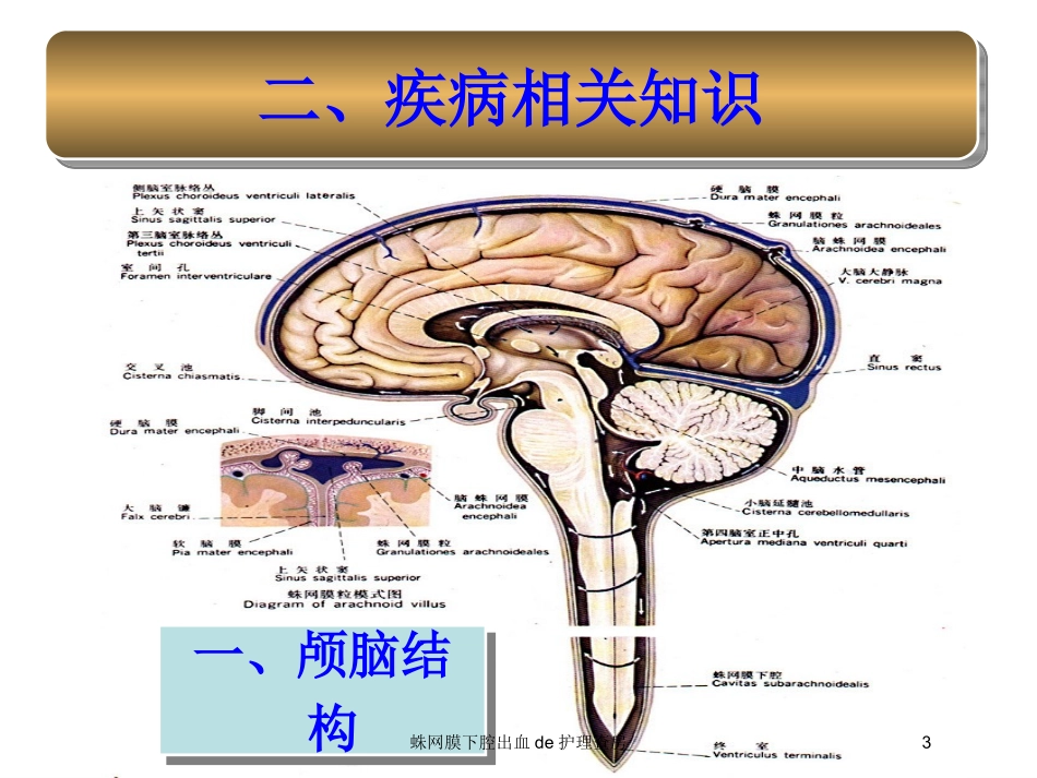 蛛网膜下腔出血的护理查房培训课件.pptx_第3页