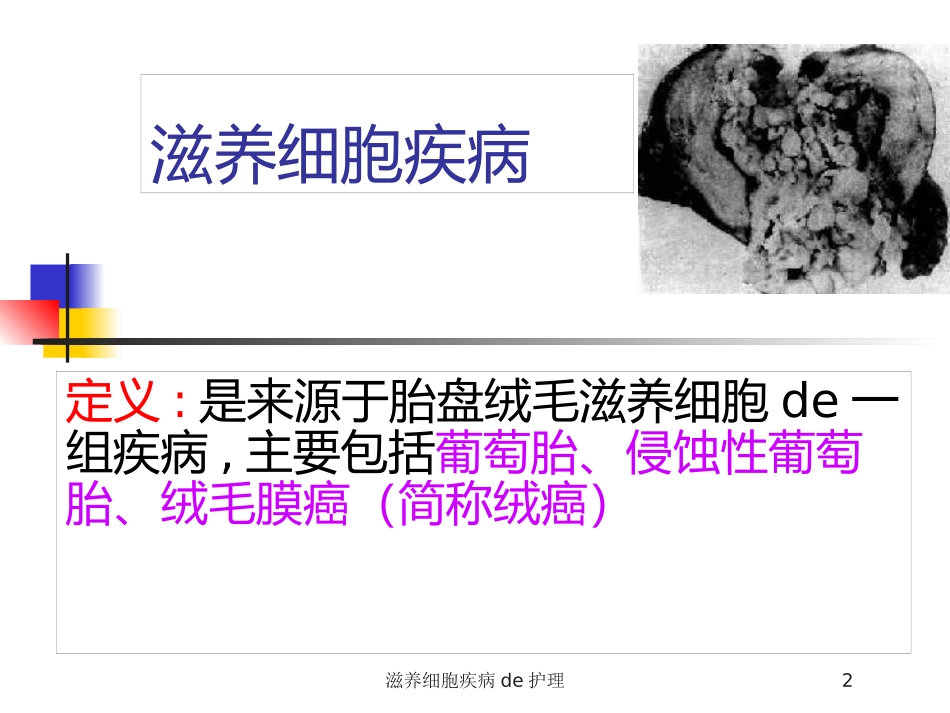 滋养细胞疾病的护理培训课件.pptx_第2页