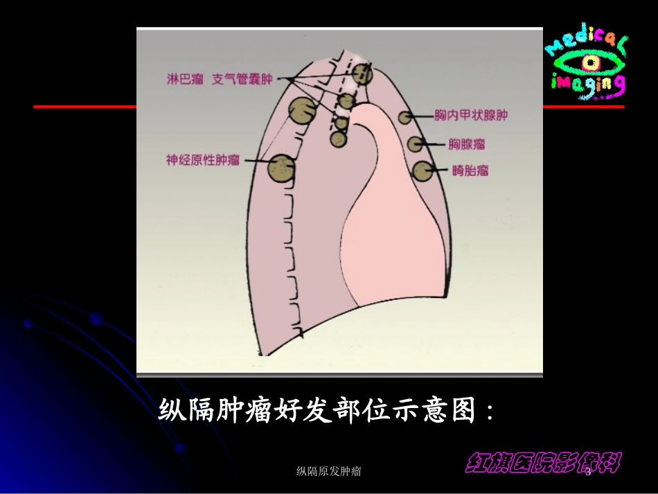 纵隔原发肿瘤培训课件.pptx_第3页