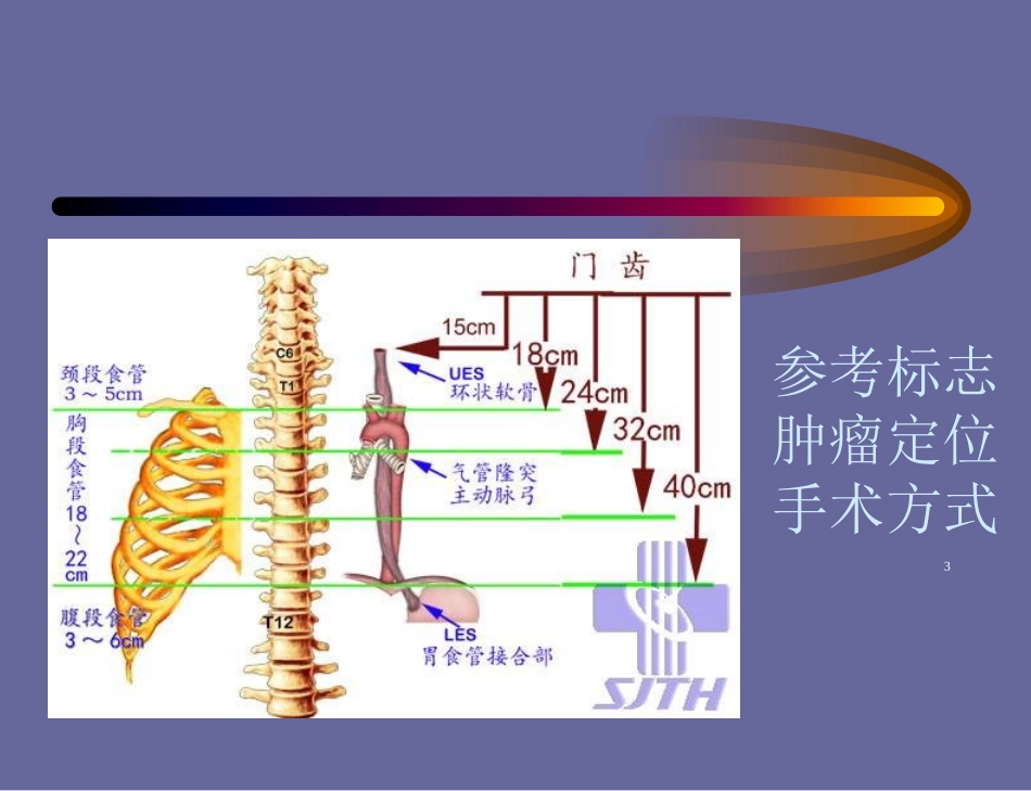 食管的临床应用解剖培训课件.pptx_第3页