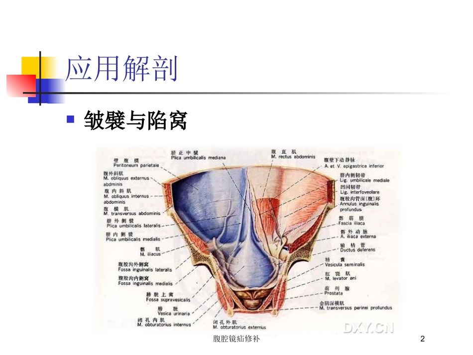 腹腔镜疝修补培训课件.pptx_第2页