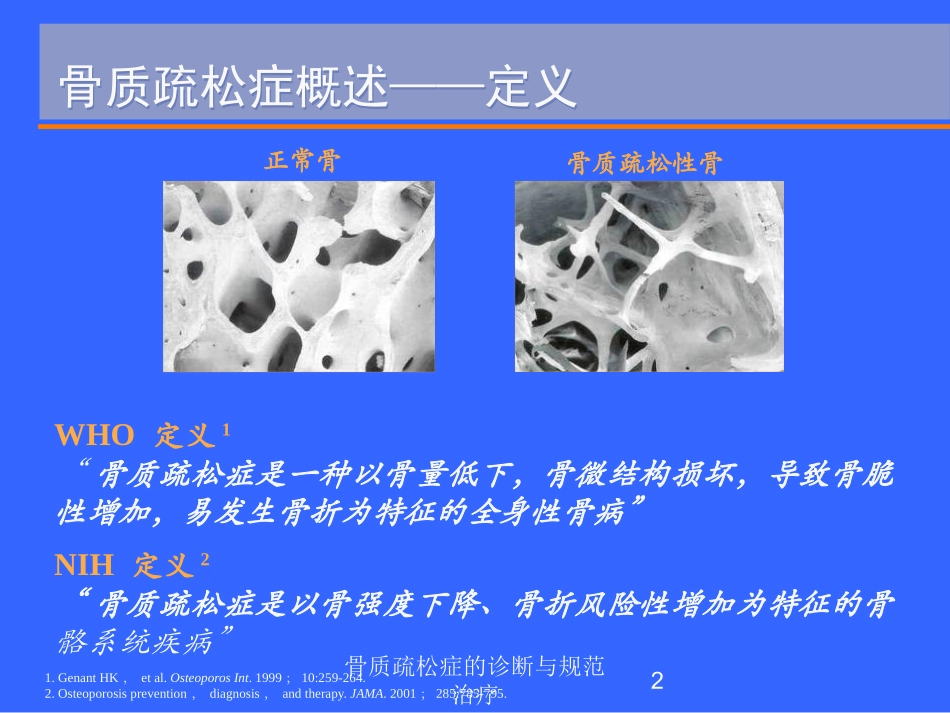 骨质疏松症的诊断与规范治疗培训课件.pptx_第2页