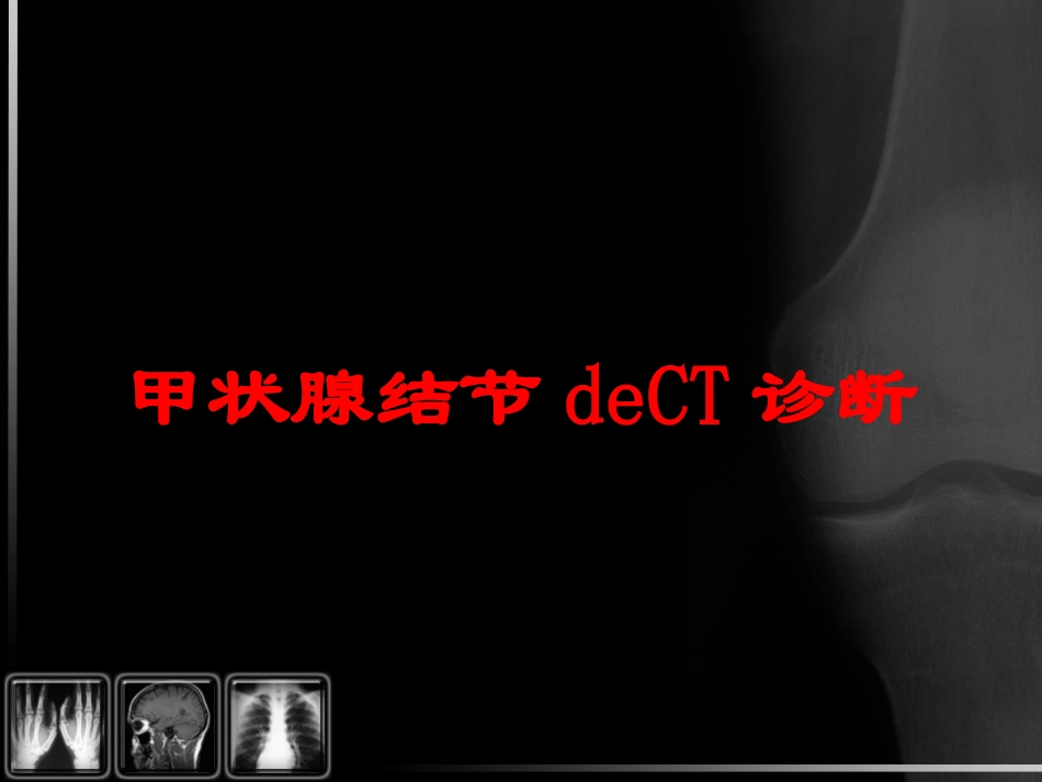 甲状腺结节的CT诊断培训课件.pptx_第1页