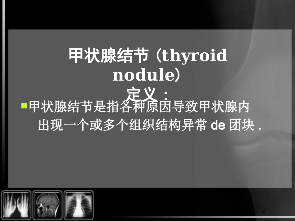 甲状腺结节的CT诊断培训课件.pptx_第2页