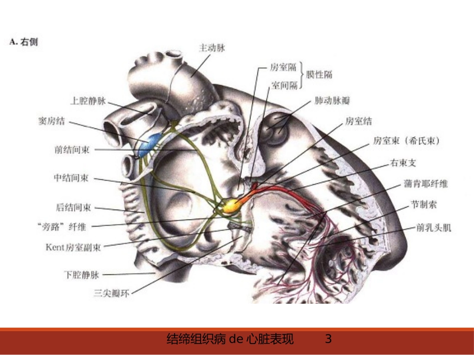 结缔组织病的心脏表现培训课件.pptx_第3页