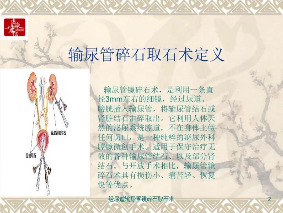 经尿道输尿管镜碎石取石术培训课件.pptx_第2页