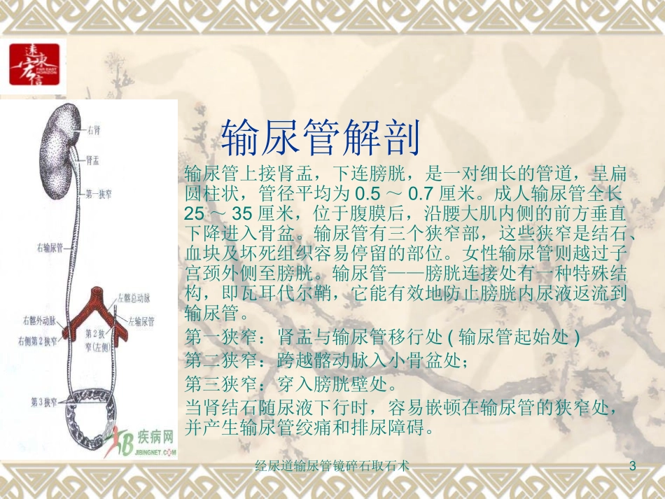 经尿道输尿管镜碎石取石术培训课件.pptx_第3页