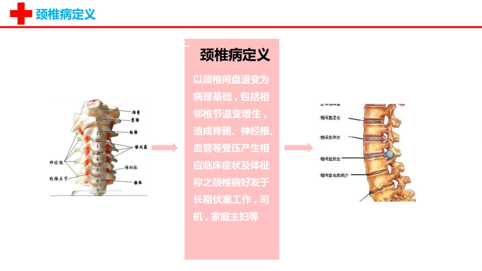 颈椎病护理查房美化.pptx_第3页
