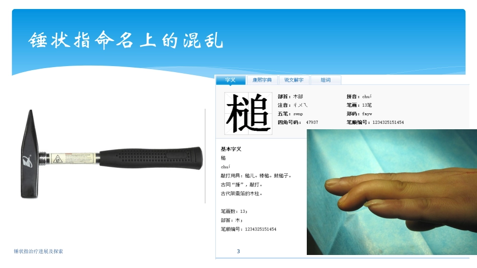 锤状指治疗进展及探索培训课件.pptx_第3页
