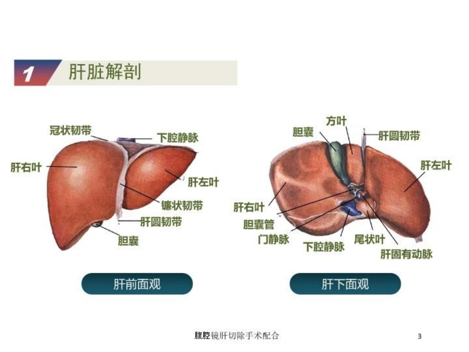 腹腔镜肝切除手术配合培训课件.pptx_第3页