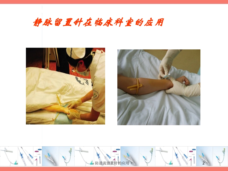 防逆流留置针的应用培训课件.pptx_第2页