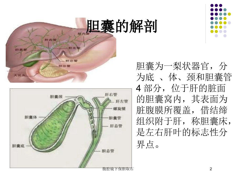 腹腔镜下保胆取石培训课件.pptx_第2页