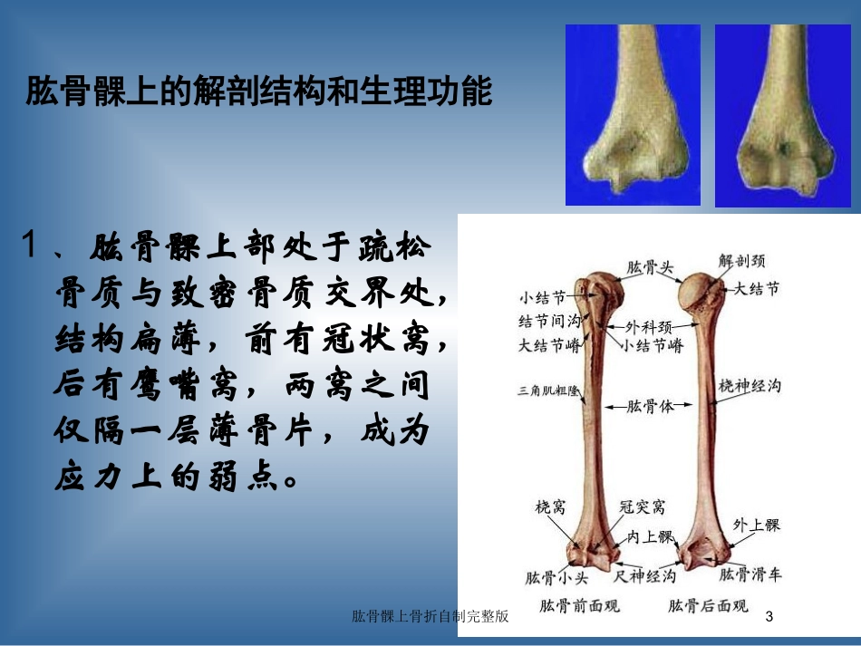 肱骨髁上骨折自制完整版培训课件.pptx_第3页