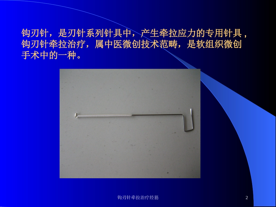 钩刃针牵拉治疗经筋培训课件.pptx_第2页