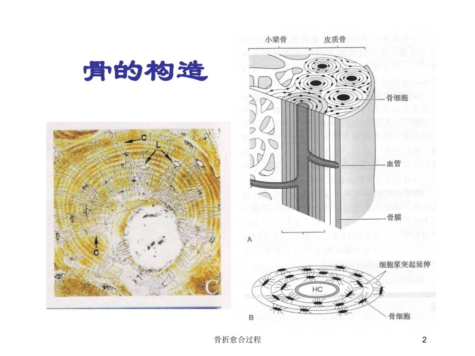 骨折愈合过程培训课件.pptx_第2页