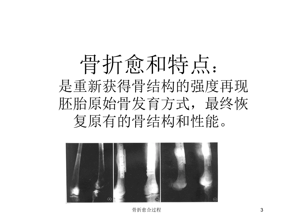 骨折愈合过程培训课件.pptx_第3页