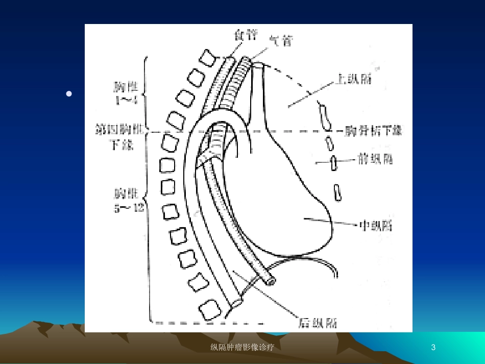 纵隔肿瘤影像诊疗培训课件.pptx_第3页