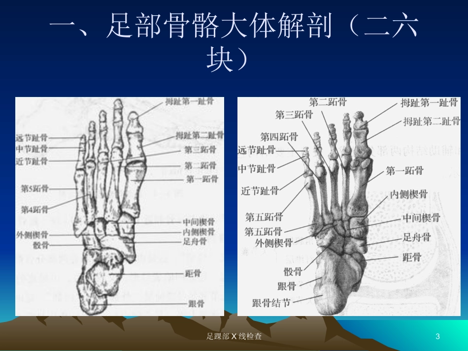 足踝部X线检查培训课件.pptx_第3页