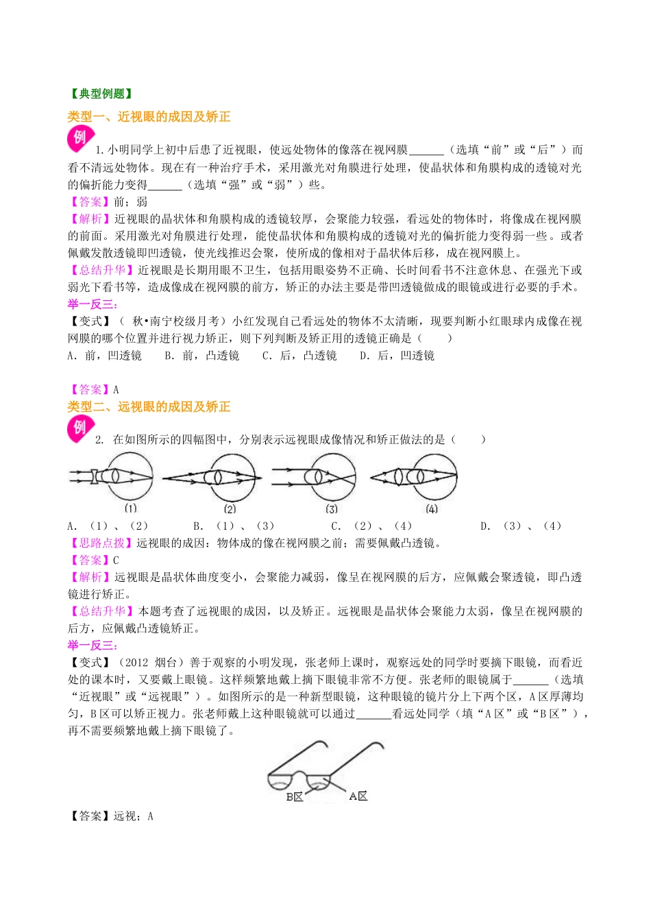 初中物理同步讲义（北师版）8下同步讲义-眼睛和眼镜 (基础) 知识讲解.doc_第3页