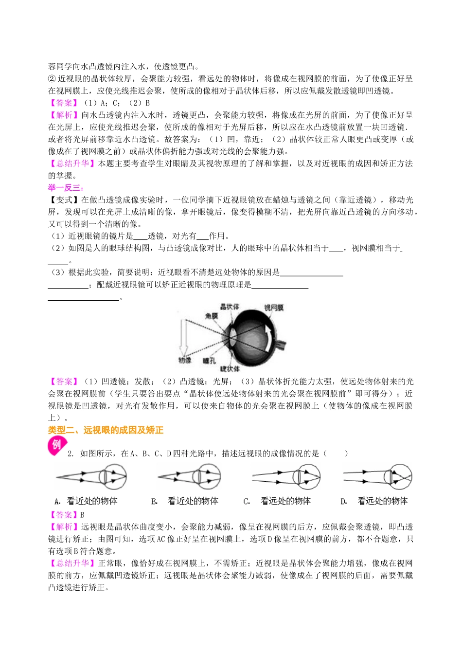 初中物理同步讲义（北师版）8下同步讲义-眼睛和眼镜 （提高） 知识讲解.doc_第3页
