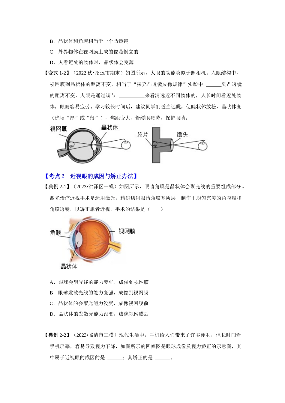 初中物理同步讲义（人教版）8上同步讲义-5.4 眼睛和眼镜（考点解读）（学生版）.docx_第3页