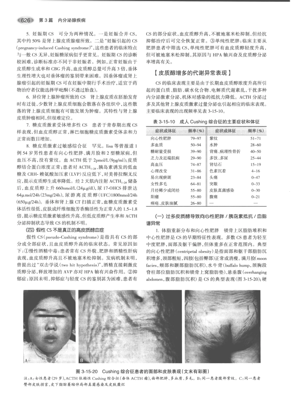 内分泌代谢病学  第3版  上册_661-675.pdf_第1页