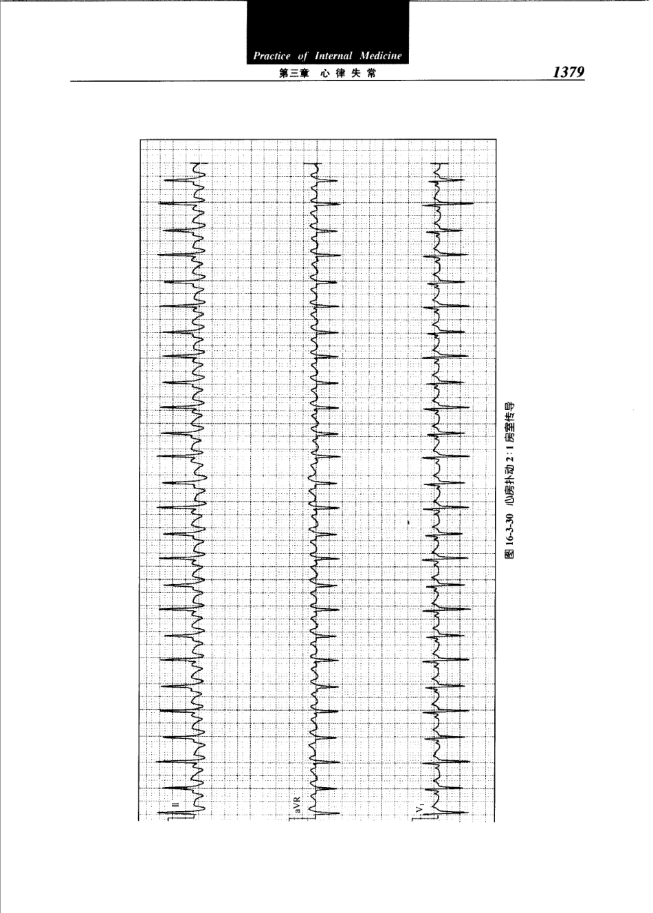 实用内科学（第12版）[www.m1835.com 1835医学网]_1401-1440.pdf_第3页