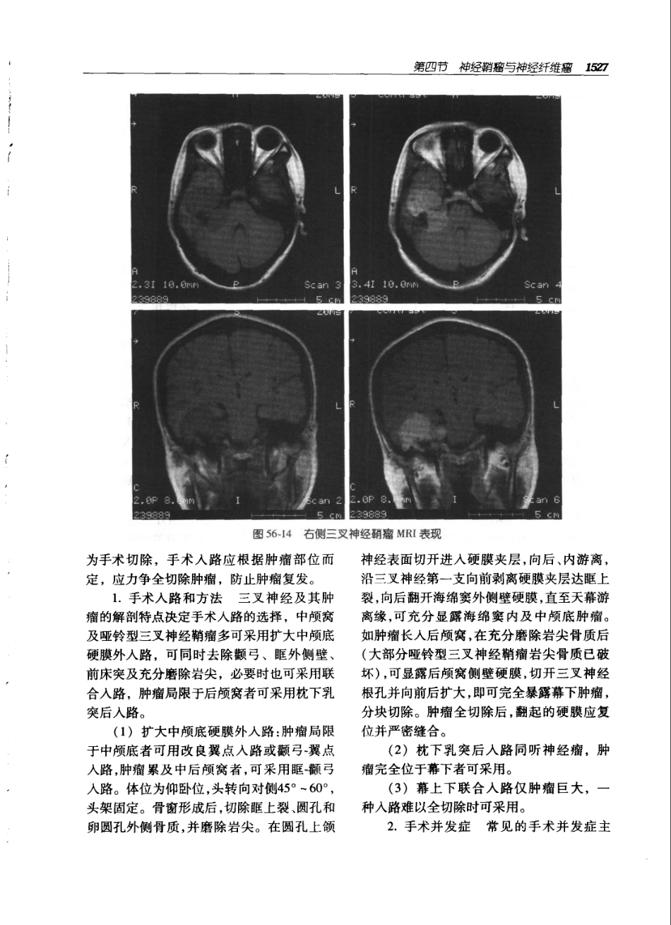 实用外科学（第二版）（上、下册）_1561-1620.pdf_第2页