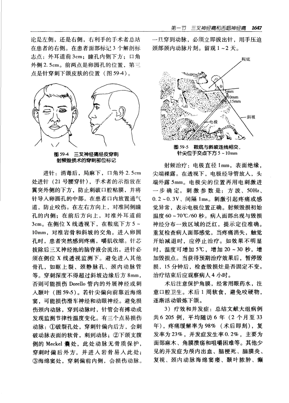 实用外科学（第二版）（上、下册）_1681-1740.pdf_第2页
