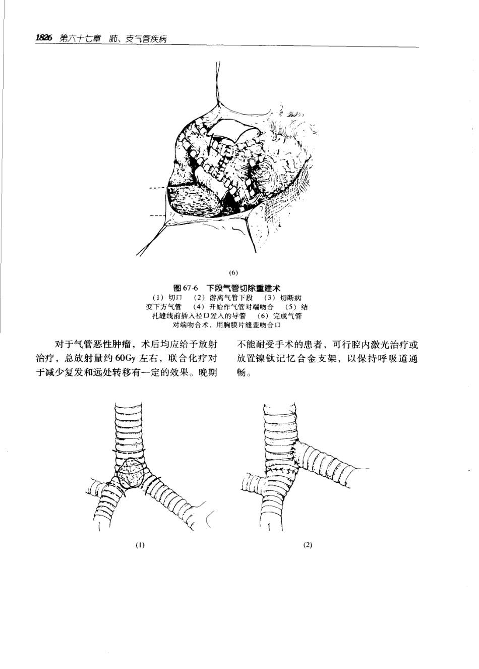 实用外科学（第二版）（上、下册）_1861-1920.pdf_第1页