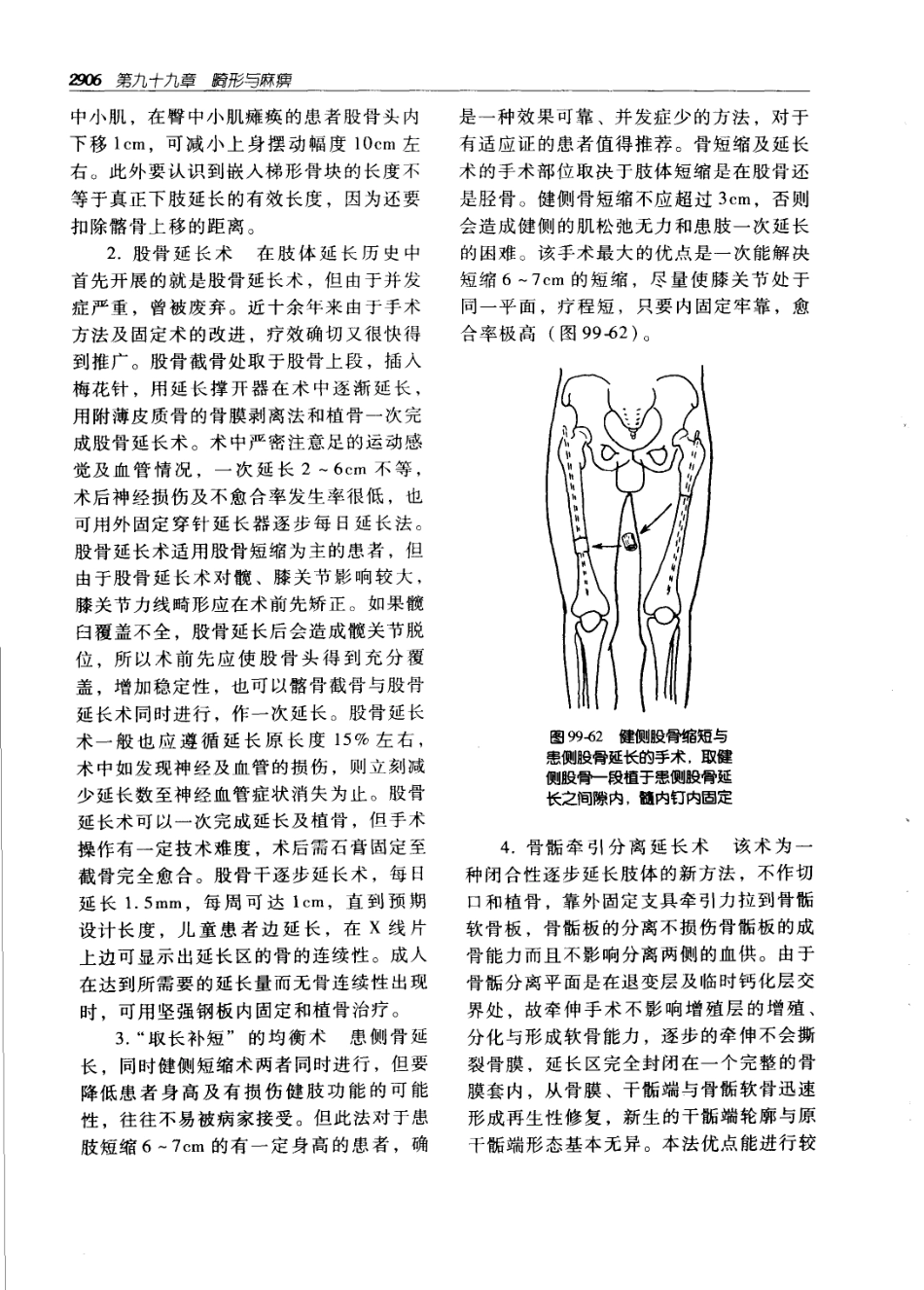 实用外科学（第二版）（上、下册）_2941-3000.pdf_第1页