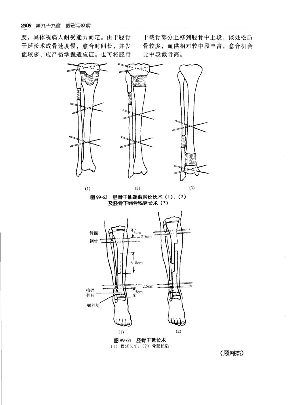 实用外科学（第二版）（上、下册）_2941-3000.pdf_第3页