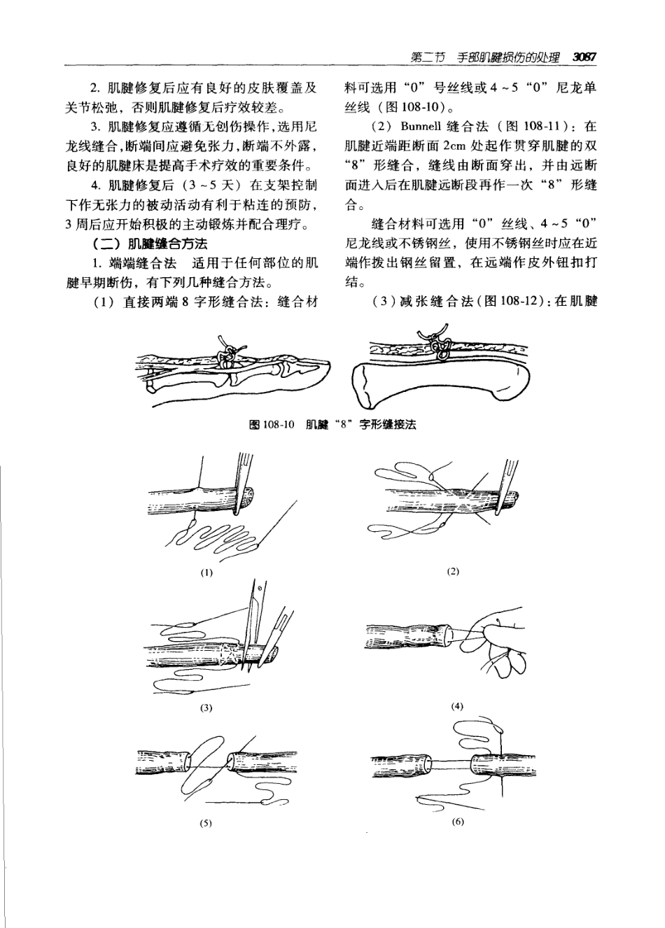 实用外科学（第二版）（上、下册）_3121-3180.pdf_第2页