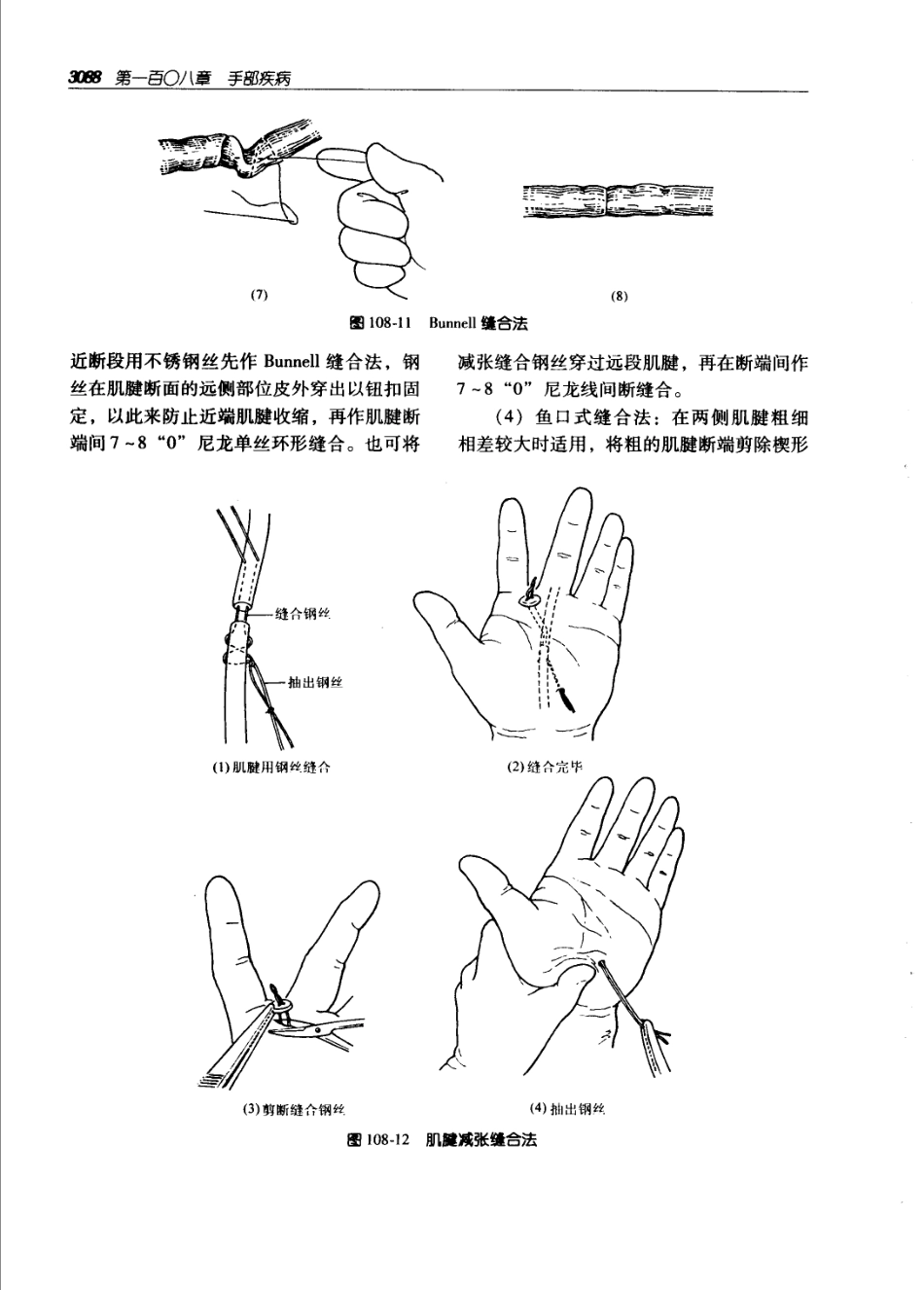 实用外科学（第二版）（上、下册）_3121-3180.pdf_第3页