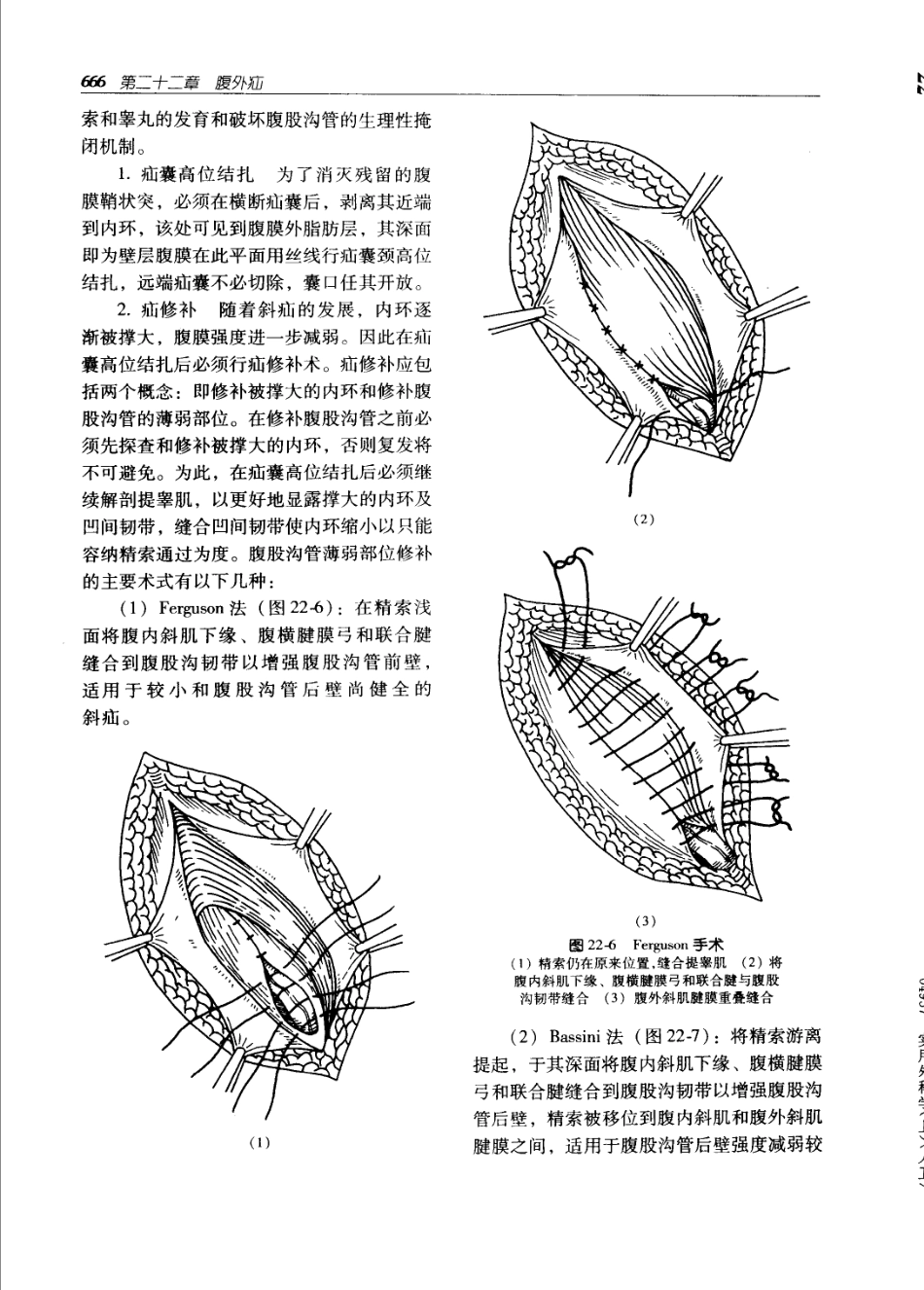 实用外科学打印版_701-800.pdf_第1页