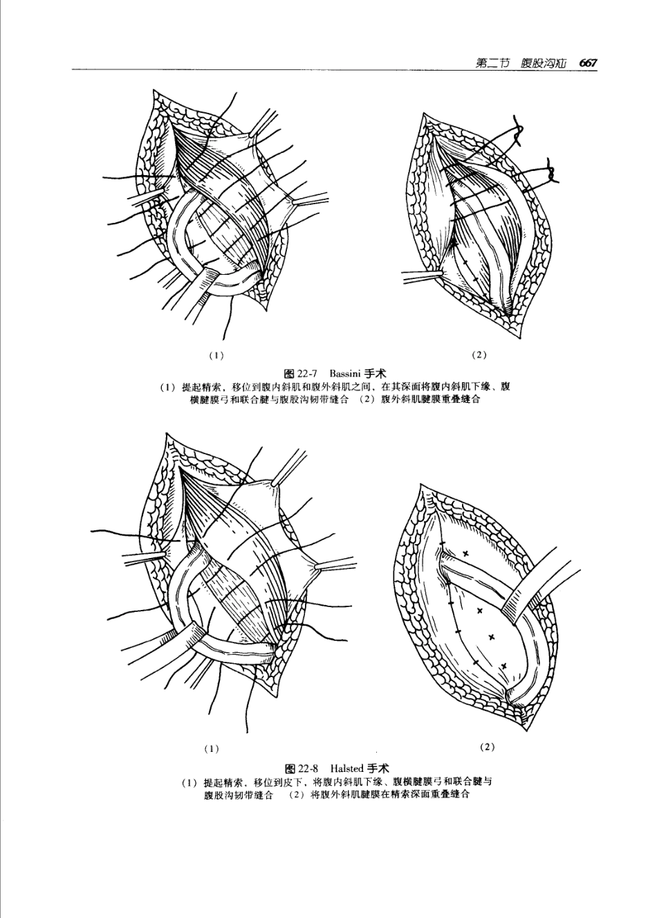 实用外科学打印版_701-800.pdf_第2页