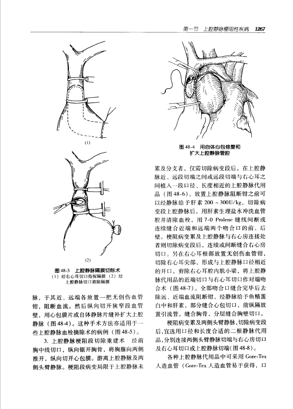 实用外科学打印版_1301-1400.pdf_第2页