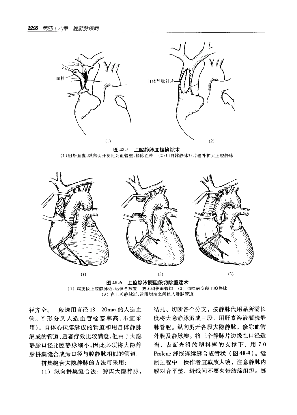 实用外科学打印版_1301-1400.pdf_第3页