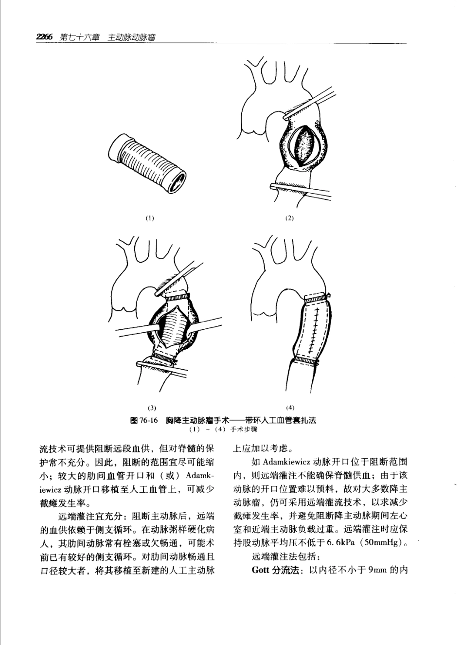 实用外科学打印版_2301-2400.pdf_第1页