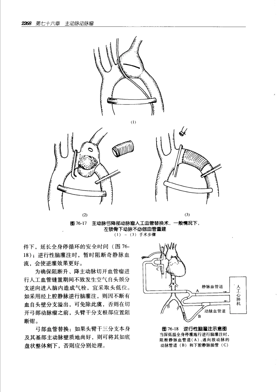 实用外科学打印版_2301-2400.pdf_第3页