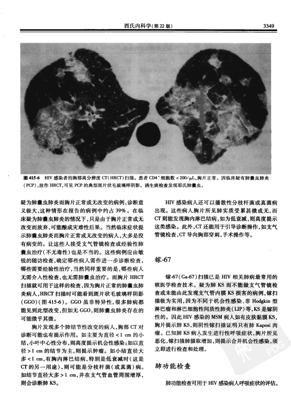 西氏内科学(中文第22版下册)_901-950.pdf_第1页