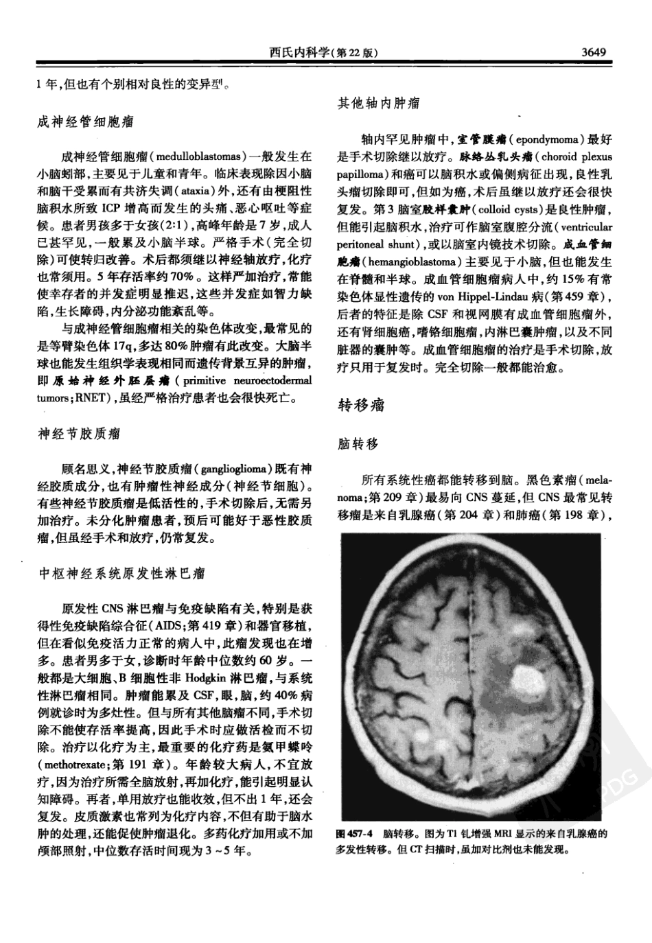 西氏内科学(中文第22版下册)_1201-1250.pdf_第1页