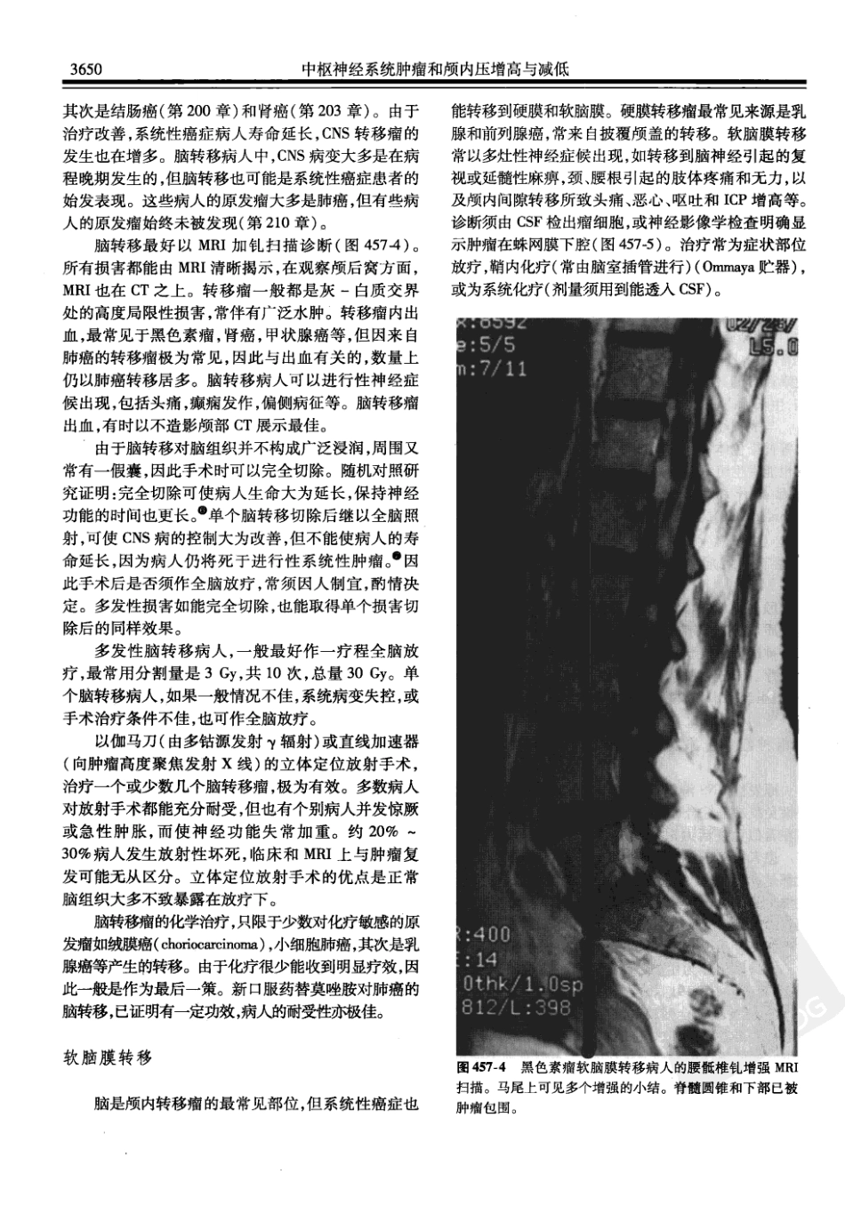 西氏内科学(中文第22版下册)_1201-1250.pdf_第2页